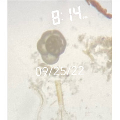 Foraminifera