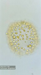 Ochrophyta