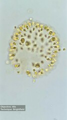 Ochrophyta
