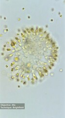 Ochrophyta