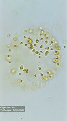 Ochrophyta