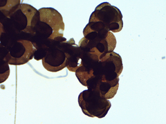 Frullania brittoniae