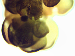 Frullania brittoniae