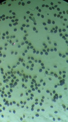 Panaeolus acuminatus