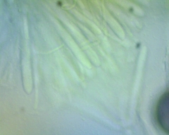 Chlorosplenium