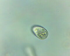 Amoebozoa