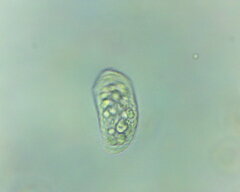 Amoebozoa