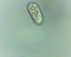 Amoebozoa