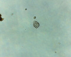 Heliozoa