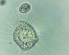 Heliozoa