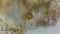 Puccinia campanulae