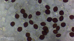 Coprinopsis pseudonivea