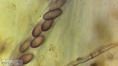 Ascobolus furfuraceus