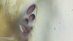 Ascobolus furfuraceus