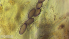 Ascobolus furfuraceus