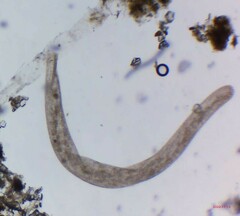 Spirostomum