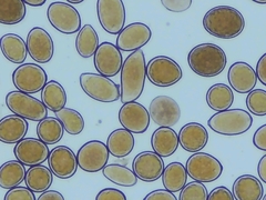 Sphaerosporium lignatile