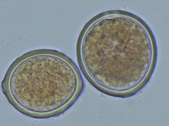 Sphaerosporium lignatile