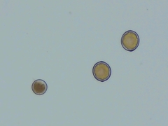 Sphaerosporium lignatile