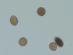 Sphaerosporium lignatile