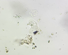 Hartmannellidae