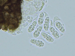 Pleosporaceae