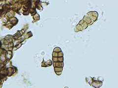 Pleosporaceae