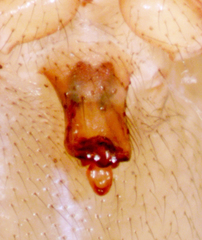 Oreonetides vaginatus