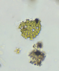 Pseudopediastrum boryanum