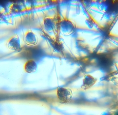 Vorticella campanula