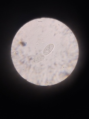 Paramecium