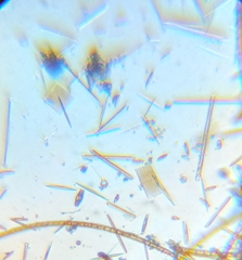 Fragilaria