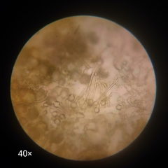 Aspergillus