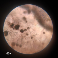 Aspergillus