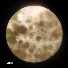Aspergillus
