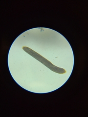 Spirostomum