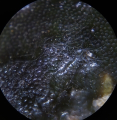 Erysiphe begoniicola