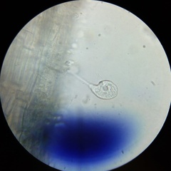 Sessilida