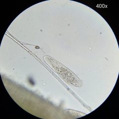Paramecium