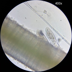Paramecium