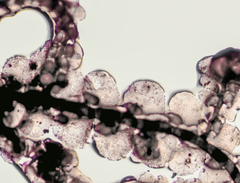 Frullania kunzei