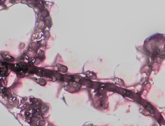 Frullania kunzei