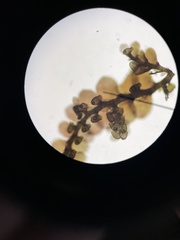 Frullania kunzei