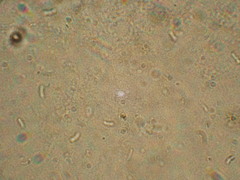 Thelephora caryophyllea