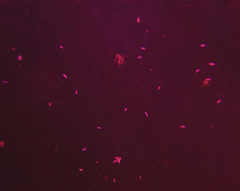 Urostylida
