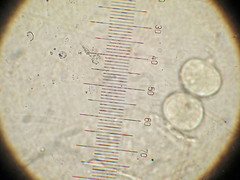 Tremella mesenterella