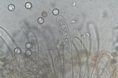 Pulvinula tetraspora