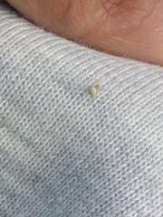 Araniella cucurbitina