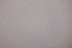 Botryobasidium subcoronatum