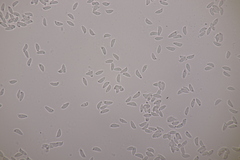 Botryobasidium subcoronatum